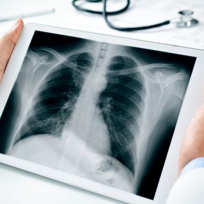 Closeup of a doctor observing a chest radiograph on a tablet