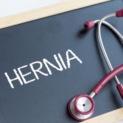 hernia surgery